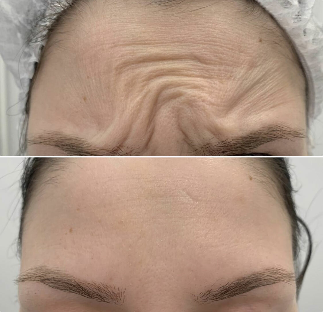 Слайд баннера