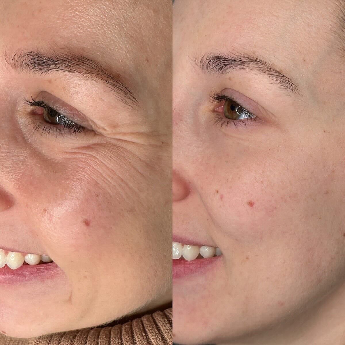 Слайд баннера